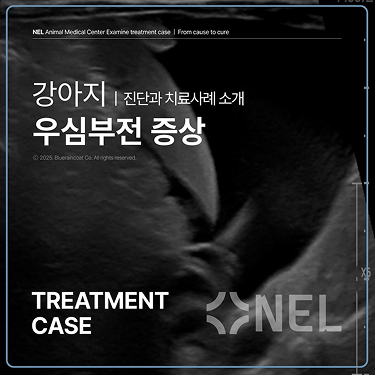 [치료사례]우심부전은 무엇이고 어떻게 관리할까?- 1편
